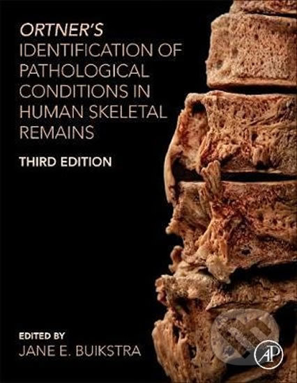 Kniha: Ortner's Identification of Pathological Conditions in Human Skeletal Remains (E. Jane Buikstr). Elsevier Science, 2019 Kniha: Ortner's Identification of Pathological Conditions in Human Skeletal Remains (E. Jane Buikstr). Elsevier Science, 2019