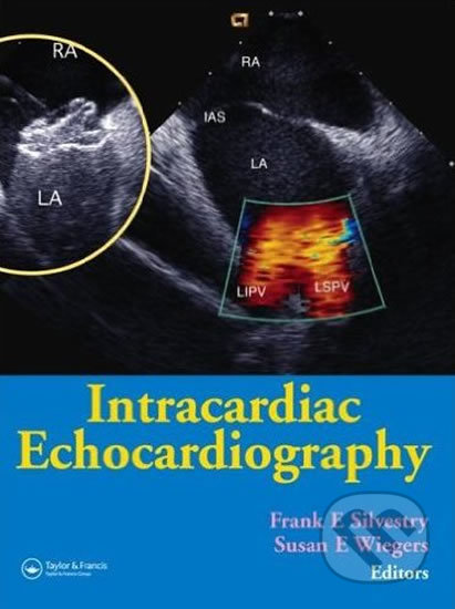 Kniha: Intracardiac Echocardiography (Frank E. Silvestry). Taylor & Francis Books, 2005 Kniha: Intracardiac Echocardiography (Frank E. Silvestry). Taylor & Francis Books, 2005