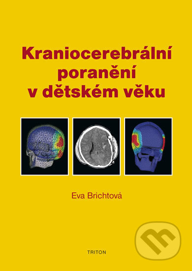 Kraniocerebrální poranění v dětském věku - Eva Brichtová, Triton, 2008