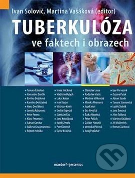 Kniha: Tuberkulóza ve faktech i obrazech (Ivan Solovič). Maxdorf, 2019 Kniha: Tuberkulóza ve faktech i obrazech (Ivan Solovič). Maxdorf, 2019