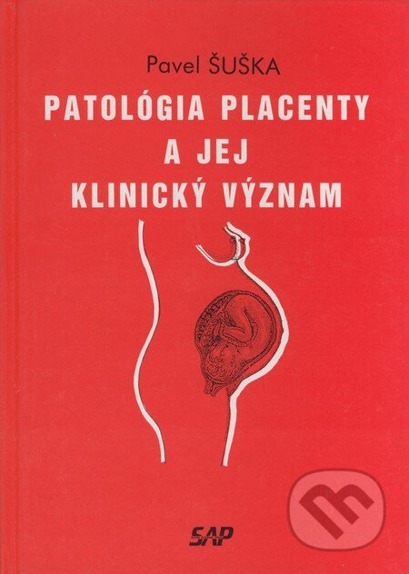 Kniha: Patológia placenty a jej klinický význam (Pavel Šuška). Slovak Academic Press, 1995 Kniha: Patológia placenty a jej klinický význam (Pavel Šuška). Slovak Academic Press, 1995