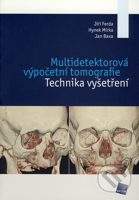 Multidetektorová výpočetní tomografie - Jiří Ferda, Hynek Mírka, Jan Baxa, Galén, 2009
