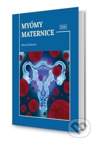 Kniha: Myómy maternice (Mikuláš Redecha). A-medi management, 2019 Kniha: Myómy maternice (Mikuláš Redecha). A-medi management, 2019