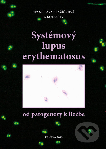 Kniha: Systémový lupus erythematosus (Autorský kolektiv). Magnet Press, 2019 Kniha: Systémový lupus erythematosus (Autorský kolektiv). Magnet Press, 2019