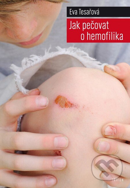 Kniha: Jak pečovat o hemofilika (Eva Tesařová). Triton, 2009 Kniha: Jak pečovat o hemofilika (Eva Tesařová). Triton, 2009