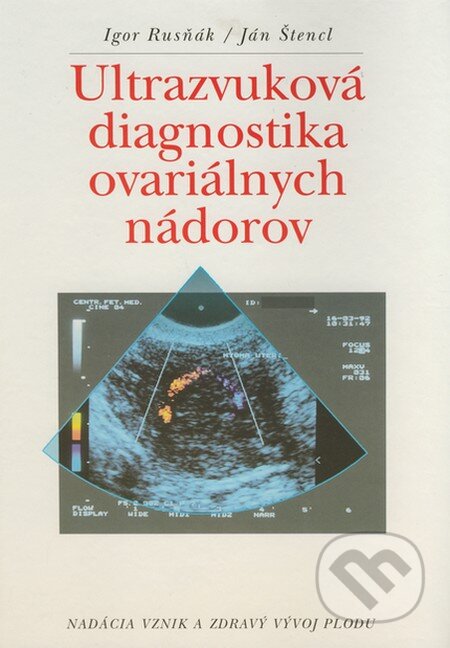 Kniha: Ultrazvuková diagnostika ovariálnych nádorov (Igor Rusňák a Ján Štencl). Nadácia vznik a zdravý vývoj plodu, 1995 Kniha: Ultrazvuková diagnostika ovariálnych nádorov (Igor Rusňák a Ján Štencl). Nadácia vznik a zdravý vývoj plodu, 1995