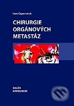 Kniha: Chirurgie orgánových metastáz (Ivan Čapov a kolektív). Karolinum Kniha: Chirurgie orgánových metastáz (Ivan Čapov a kolektív). Karolinum