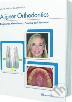 Kniha: Aligner Orthodontics (Julia Haubrich a Werner Schup). Quintessenz Verlags, 2017 Kniha: Aligner Orthodontics (Julia Haubrich a Werner Schup). Quintessenz Verlags, 2017