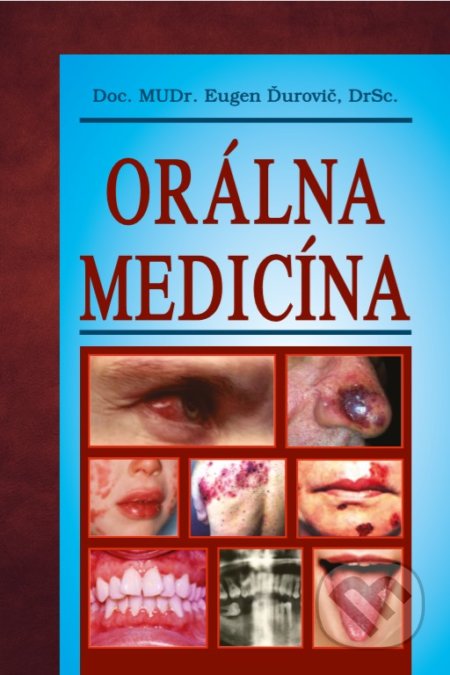 Kniha: Orálna medicína (Eugen Ďurovič). Vydavateľstvo P + M, 2020 Kniha: Orálna medicína (Eugen Ďurovič). Vydavateľstvo P + M, 2020