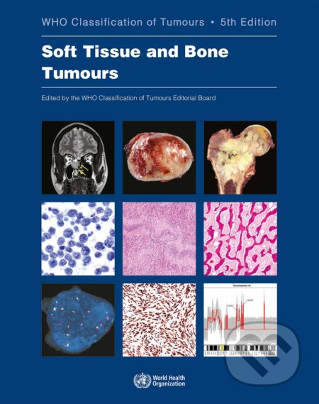 Kniha: Soft Tissue and Bone Tumours (World Health Organization). World Health Organization, 2020 Kniha: Soft Tissue and Bone Tumours (World Health Organization). World Health Organization, 2020