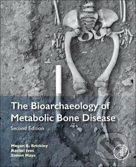 Kniha: The Bioarchaeology of Metabolic Bone Disease (Megan B. Brickley, Rachel Ives a Simon Mays). Elsevier Science, 2020 Kniha: The Bioarchaeology of Metabolic Bone Disease (Megan B. Brickley, Rachel Ives a Simon Mays). Elsevier Science, 2020