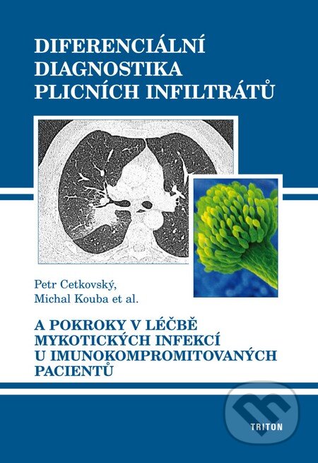 Kniha: Diferenciální diagnostika plicních infiltrátů (Michal Kouba, Petr Cetkovský a kolektiv). Triton, 2010 Kniha: Diferenciální diagnostika plicních infiltrátů (Michal Kouba, Petr Cetkovský a kolektiv). Triton, 2010