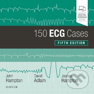 Kniha: 150 ECG Cases (David Adlam, Joanna Hampton a John Hampton). Elsevier Science, 2019 Kniha: 150 ECG Cases (David Adlam, Joanna Hampton a John Hampton). Elsevier Science, 2019