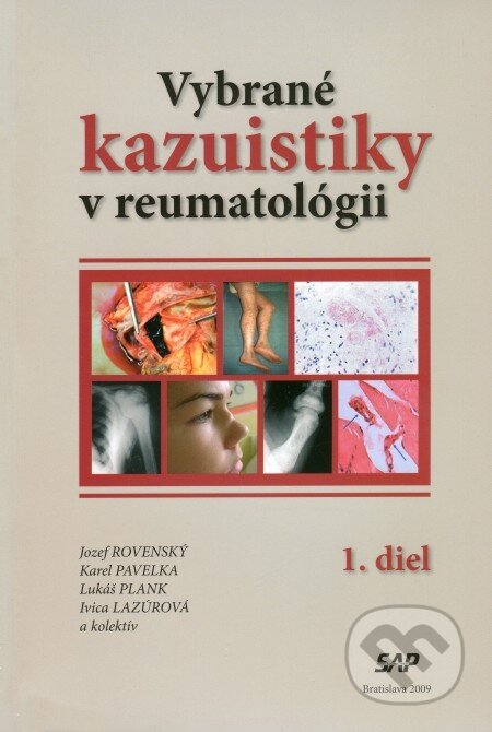 Kniha: Vybrané kazuistiky v reumatológii (1+2 diel) (Ivica Lazúrová, Jozef Rovenský, Karel Pavelka a Lukáš Plank). Slovak Academic Press, 2009 Kniha: Vybrané kazuistiky v reumatológii (1+2 diel) (Ivica Lazúrová, Jozef Rovenský, Karel Pavelka a Lukáš Plank). Slovak Academic Press, 2009