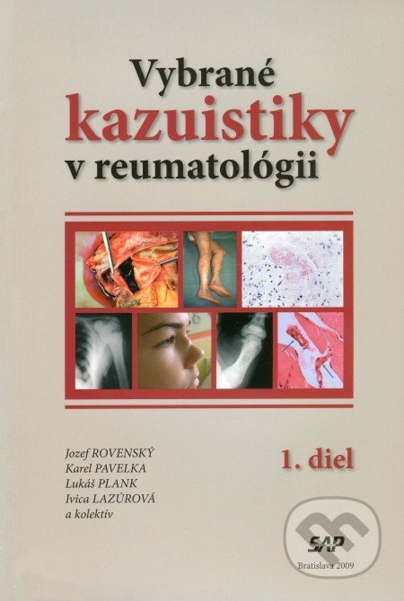 Vybrané kazuistiky v reumatológii (1+2 diel) - Jozef Rovenský, Karel Pavelka, Lukáš Plank, Ivica Lazúrová, Slovak Academic Press, 2009