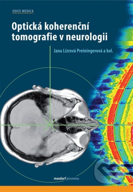 Kniha: Optická koherenční tomografie v neurologii (Jana Preiningerová Lízrová). Maxdorf, 2020 Kniha: Optická koherenční tomografie v neurologii (Jana Preiningerová Lízrová). Maxdorf, 2020