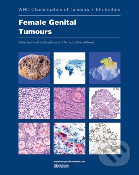 Kniha: Female Genital Tumours (World Health Organization). World Health Organization, 2020 Kniha: Female Genital Tumours (World Health Organization). World Health Organization, 2020