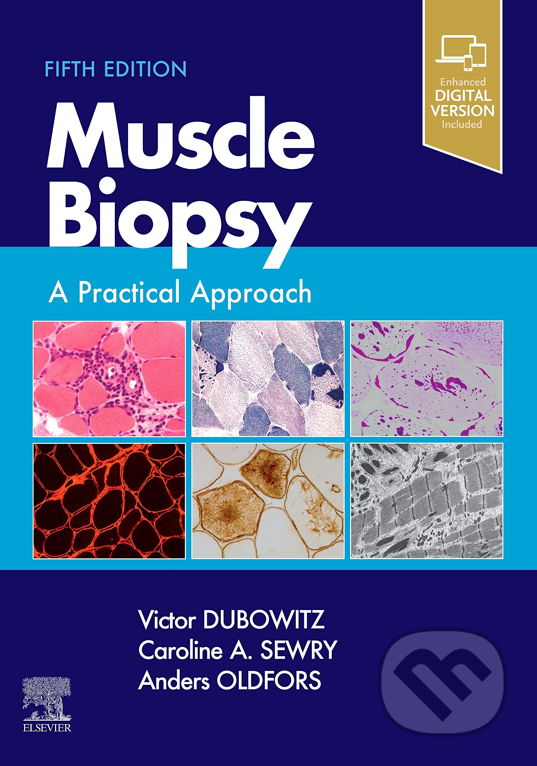 Kniha: Muscle Biopsy (Victor Dubowitz, Caroline A. Sewry a Anders Oldfors). Elsevier Science, 2020 Kniha: Muscle Biopsy (Victor Dubowitz, Caroline A. Sewry a Anders Oldfors). Elsevier Science, 2020
