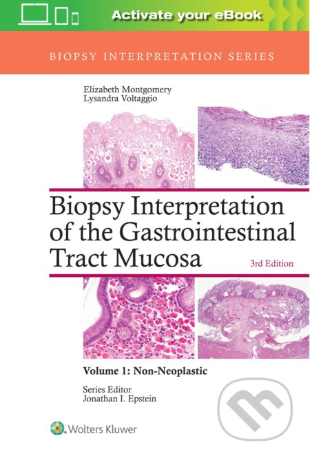 Kniha: Biopsy Interpretation of the Gastrointestinal Tract Mucosa Volume 1 (Elizabeth A. Montgomery a Lysandra Voltaggio). Lippincott Williams & Wilkins, 2017 Kniha: Biopsy Interpretation of the Gastrointestinal Tract Mucosa Volume 1 (Elizabeth A. Montgomery a Lysandra Voltaggio). Lippincott Williams & Wilkins, 2017