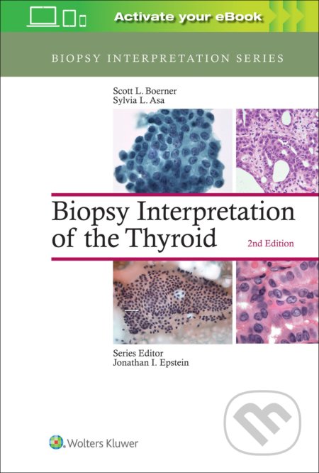 Kniha: Biopsy Interpretation of the Thyroid (Scott L. Boerner a Sylvia L. Asa). Lippincott Williams & Wilkins, 2016 Kniha: Biopsy Interpretation of the Thyroid (Scott L. Boerner a Sylvia L. Asa). Lippincott Williams & Wilkins, 2016