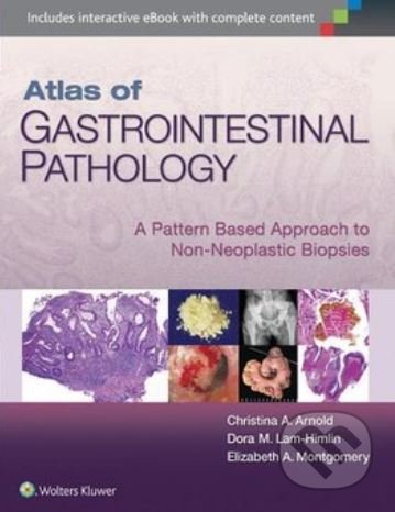 Kniha: Atlas of Gastrointestinal Pathology (Christina Arnold, Dora Lam-Himlin a Elizabeth A. Montgomery). Lippincott Williams & Wilkins, 2014 Kniha: Atlas of Gastrointestinal Pathology (Christina Arnold, Dora Lam-Himlin a Elizabeth A. Montgomery). Lippincott Williams & Wilkins, 2014