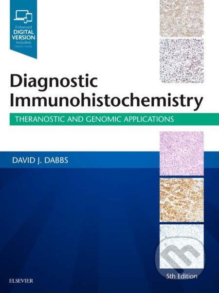 Kniha: Diagnostic Immunohistochemistry (David J. Dabbs). Elsevier Science, 2018 Kniha: Diagnostic Immunohistochemistry (David J. Dabbs). Elsevier Science, 2018