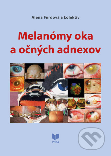 Kniha: Melanómy oka a očných adnexov (Alena Furdová a kolektív). VEDA, 2020 Kniha: Melanómy oka a očných adnexov (Alena Furdová a kolektív). VEDA, 2020