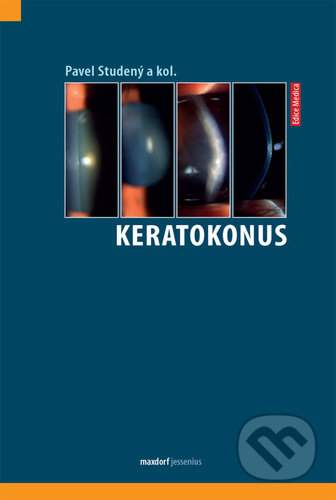 Kniha: Keratokonus (Pavel Studený). Maxdorf, 2021 Kniha: Keratokonus (Pavel Studený). Maxdorf, 2021