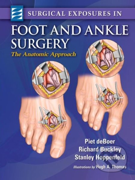 Surgical Exposures in Foot & Ankle Surgery - Piet Deboer, Lippincott Williams & Wilkins, 2012