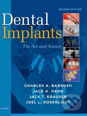 Dental Implants - Charles A. Babbush et al., Saunders, 2010