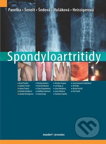Kniha: Spondyloartritidy (Karel Pavelka, Ladislav Šenolt a Liliana Šedová). Maxdorf, 2021 Kniha: Spondyloartritidy (Karel Pavelka, Ladislav Šenolt a Liliana Šedová). Maxdorf, 2021