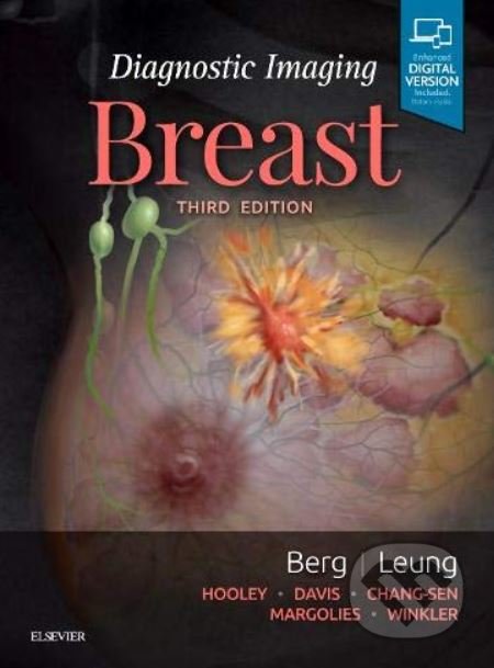 Kniha: Diagnostic Imaging: Breast (Wendie A. Berg a Jessica Leung). Elsevier Science, 2019 Kniha: Diagnostic Imaging: Breast (Wendie A. Berg a Jessica Leung). Elsevier Science, 2019