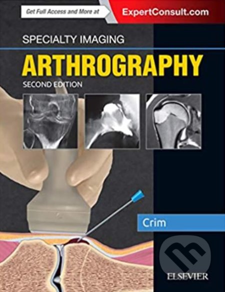 Kniha: Specialty Imaging: Arthrography (Julia R. Crim). Elsevier Science, 2018 Kniha: Specialty Imaging: Arthrography (Julia R. Crim). Elsevier Science, 2018