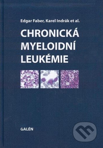 Kniha: Chronická myeloidní leukemie (Edgar Faber, Karel Indrák a kolektív). Galén, 2010 Kniha: Chronická myeloidní leukemie (Edgar Faber, Karel Indrák a kolektív). Galén, 2010