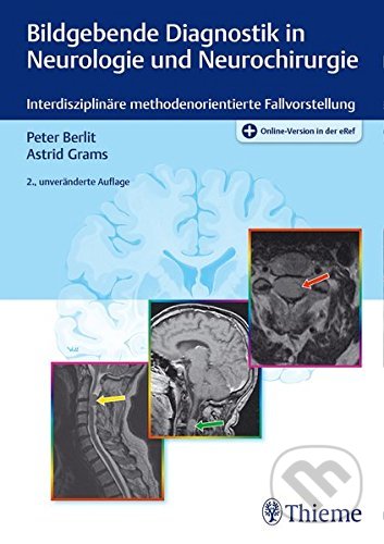 Bildgebende Diagnostik in Neurologie und Neurochirurgie - Peter Berlit, Astrid E. Grams, Thieme, 2016