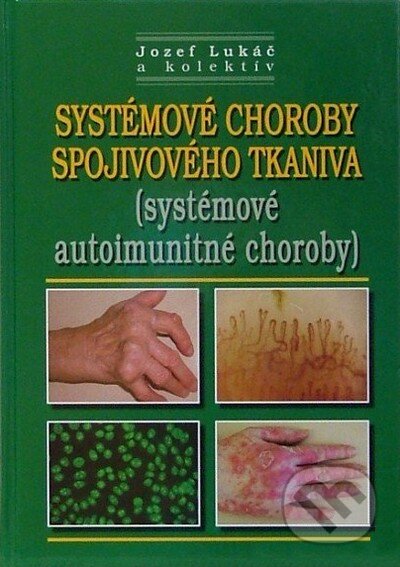 Kniha: Systémové choroby spojivového tkaniva (systémové autoimunitné choroby) (Jozef Lukáč a kolektiv). Osveta, 2010 Kniha: Systémové choroby spojivového tkaniva (systémové autoimunitné choroby) (Jozef Lukáč a kolektiv). Osveta, 2010