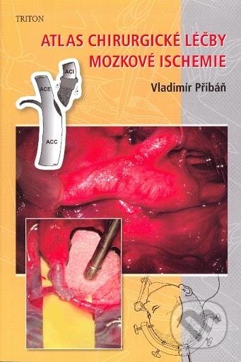 Atlas chirurgické léčby mozkové ischemie - Vladimír Přibáň, Triton, 2010