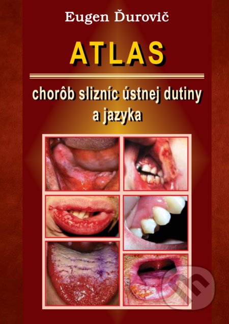 Kniha: Atlas chorôb slizníc ústnej dutiny a jazyka (Eugen Ďurovič). Vydavateľstvo P + M, 2021 Kniha: Atlas chorôb slizníc ústnej dutiny a jazyka (Eugen Ďurovič). Vydavateľstvo P + M, 2021