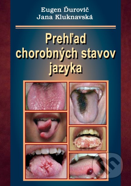 Kniha: Prehľad chorobných stavov jazyka (Eugen Ďurovič a Jana Kluknavská). Vydavateľstvo P + M, 2021 Kniha: Prehľad chorobných stavov jazyka (Eugen Ďurovič a Jana Kluknavská). Vydavateľstvo P + M, 2021