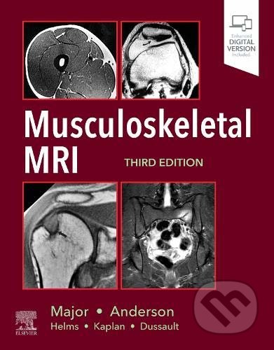 Kniha: Musculoskeletal MRI (Mark W. Anderson a Nancy M. Major). Elsevier Science, 2020 Kniha: Musculoskeletal MRI (Mark W. Anderson a Nancy M. Major). Elsevier Science, 2020