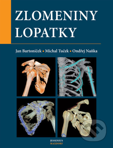 Kniha: Zlomeniny lopatky (Jan Bartoníček, Michal Tuček a Ondřej Naňka). Maxdorf, 2021 Kniha: Zlomeniny lopatky (Jan Bartoníček, Michal Tuček a Ondřej Naňka). Maxdorf, 2021