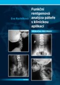 Funkční rentgenová analýza páteře s klinickou aplikací - Eva Rychlíková, Triton, 2012