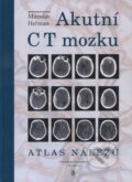 Kniha: Akutní CT mozku (Miroslav Heřman). Univerzita Palackého v Olomouci, 2006 Kniha: Akutní CT mozku (Miroslav Heřman). Univerzita Palackého v Olomouci, 2006