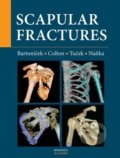 Kniha: Scapular fractures (Jan Bartoníček, Michal Tuček a Ondřej Naňka). Maxdorf, 2022 Kniha: Scapular fractures (Jan Bartoníček, Michal Tuček a Ondřej Naňka). Maxdorf, 2022