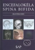Kniha: Encefalokéla spina bifida (František Horn). Slovak Academic Press, 2022 Kniha: Encefalokéla spina bifida (František Horn). Slovak Academic Press, 2022