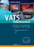 Kniha: VATS lobektomie (Vladislav Hytych). Maxdorf, 2015 Kniha: VATS lobektomie (Vladislav Hytych). Maxdorf, 2015