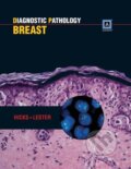 Kniha: Diagnostic Pathology: Breast (David G. Hicks Susan C. Lester). Amirsys, 2011 Kniha: Diagnostic Pathology: Breast (David G. Hicks Susan C. Lester). Amirsys, 2011