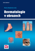 Revmatologie v obrazech - Marta Olejárová, 2016