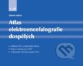 Kniha: Atlas elektroencefalografie dospělých (Zdeněk Vojtěch). Triton, 2024 Kniha: Atlas elektroencefalografie dospělých (Zdeněk Vojtěch). Triton, 2024
