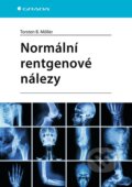 Kniha: Normální rentgenové nálezy (Torsten B. Möller). Grada, 2024 Kniha: Normální rentgenové nálezy (Torsten B. Möller). Grada, 2024